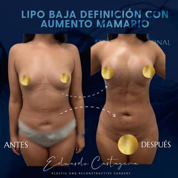 Slider image (9) Dr. Eduardo Cartagena - Plastic Surgeon in Mexico City